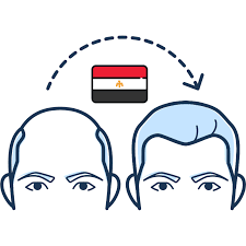 Sekhmet Tours – Medical Tourism Package Hair Transplant & 9-Day Egypt Tour for Two Special Offer: $2,600